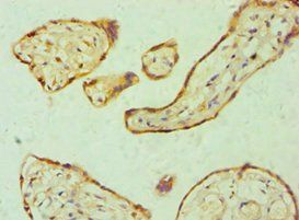 GSDME Antibody