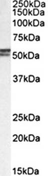 DGAT1 (aa67-79) Antibody