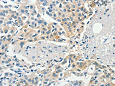 DGKB Antibody
