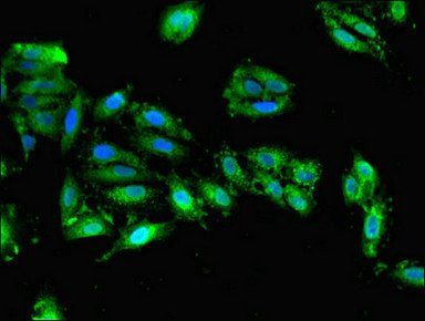 DHFR Antibody