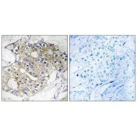 DHRS4 Antibody