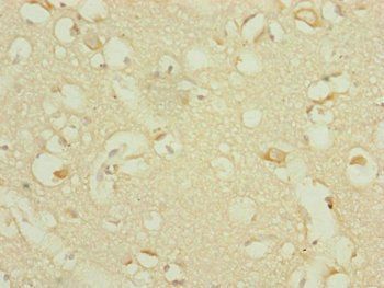 DHTKD1 Antibody