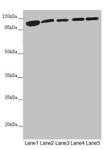 DHTKD1 Antibody