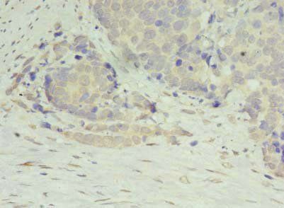 DIP2A Antibody