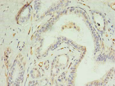 DIP2A Antibody