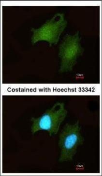 DIP2B Rabbit Polyclonal Antibody