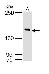 DIP2B Rabbit Polyclonal Antibody
