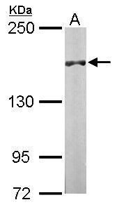 DIP2B Rabbit Polyclonal Antibody