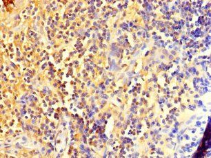 DIS3L2 Antibody