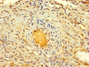 DIS3L2 Antibody