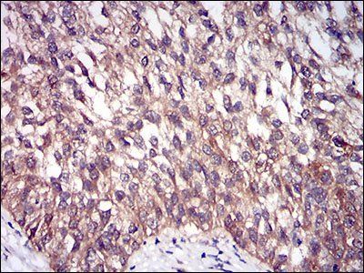 DIS3L2 Antibody