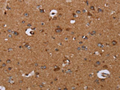 DISC1 Antibody