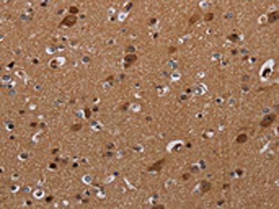 DISC1 Antibody