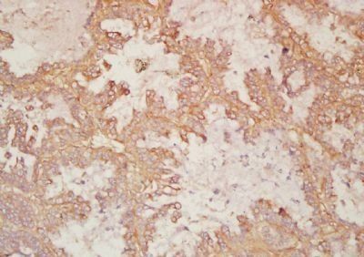 DISP2 Rabbit Polyclonal Antibody