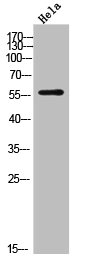 DKC1 Antibody