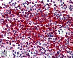 DKC1 Antibody