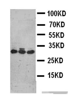 Dickkopf-related protein 1 DKK1 Rabbit Polyclonal Antibody