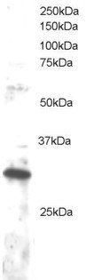 DKK4 Antibody