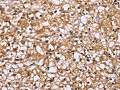 DLD Antibody