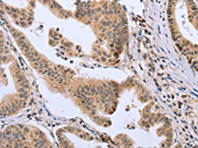 DLD Antibody