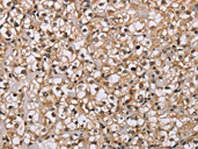 DLD Antibody