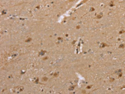 DLD Antibody