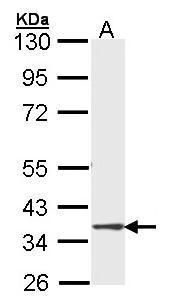 DMC1 antibody [N1C1]