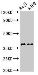 DMC1 Antibody