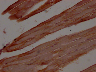 DMD Antibody
