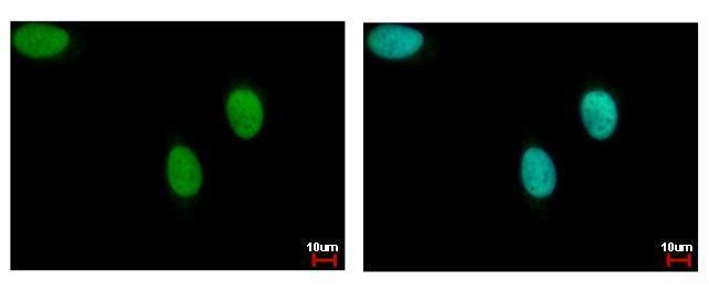 DNA ligase III Rabbit Polyclonal Antibody