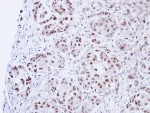 DNA ligase III Rabbit Polyclonal Antibody