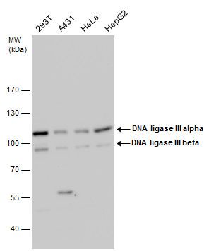DNA ligase III Rabbit Polyclonal Antibody