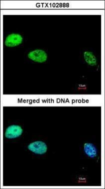 DNA polymerase delta Rabbit Polyclonal Antibody