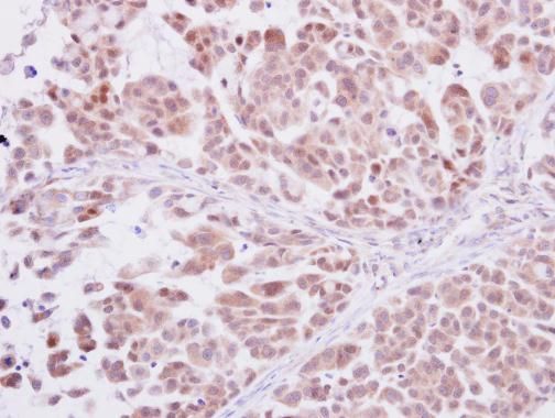 DNA polymerase delta Rabbit Polyclonal Antibody
