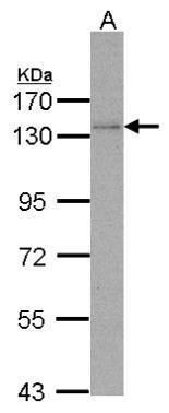 DNA polymerase delta Rabbit Polyclonal Antibody