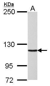 DNA polymerase delta Rabbit Polyclonal Antibody