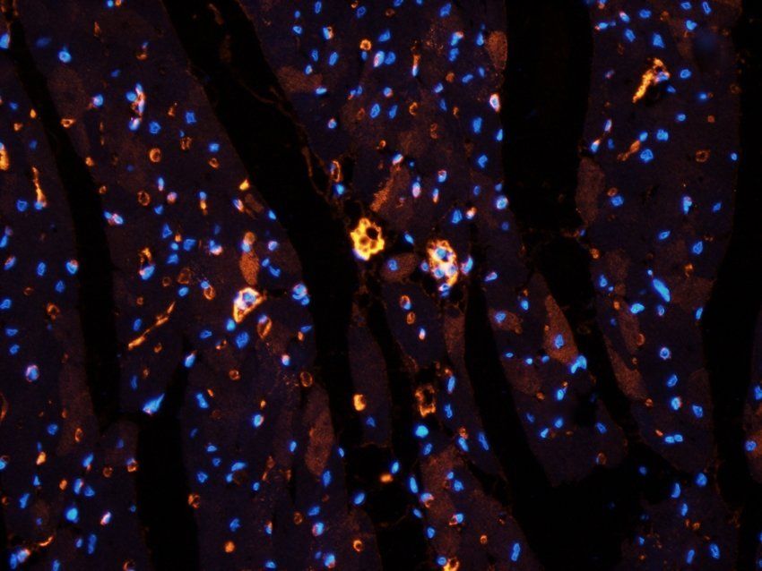 DNA polymerase theta Rabbit Polyclonal Antibody