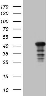 LRRC6 Antibody