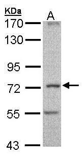 CCDC68 Rabbit Polyclonal Antibody