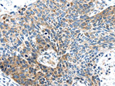 DNAJA3 Antibody