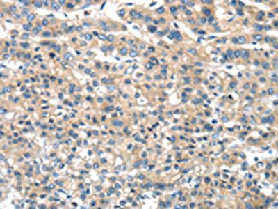 DNAJA3 Antibody