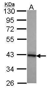 DNAJB2 Rabbit Polyclonal Antibody