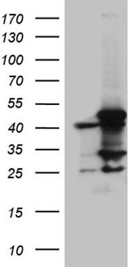 DNAJB5 Antibody