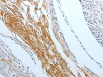DNAJC10 Antibody