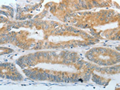 DNAJC3 Antibody
