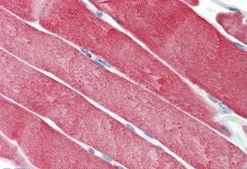 Dnajc5 (aa177-191) Antibody