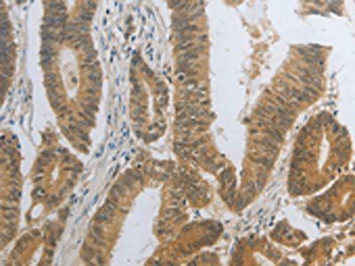 DNAJC7 Antibody