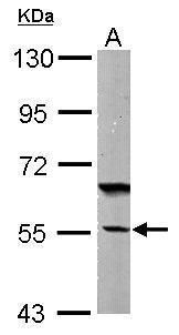 DNAJC7 antibody [N2C3]