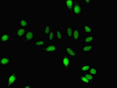 DNM1 Antibody