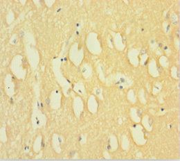 DNM1 Antibody